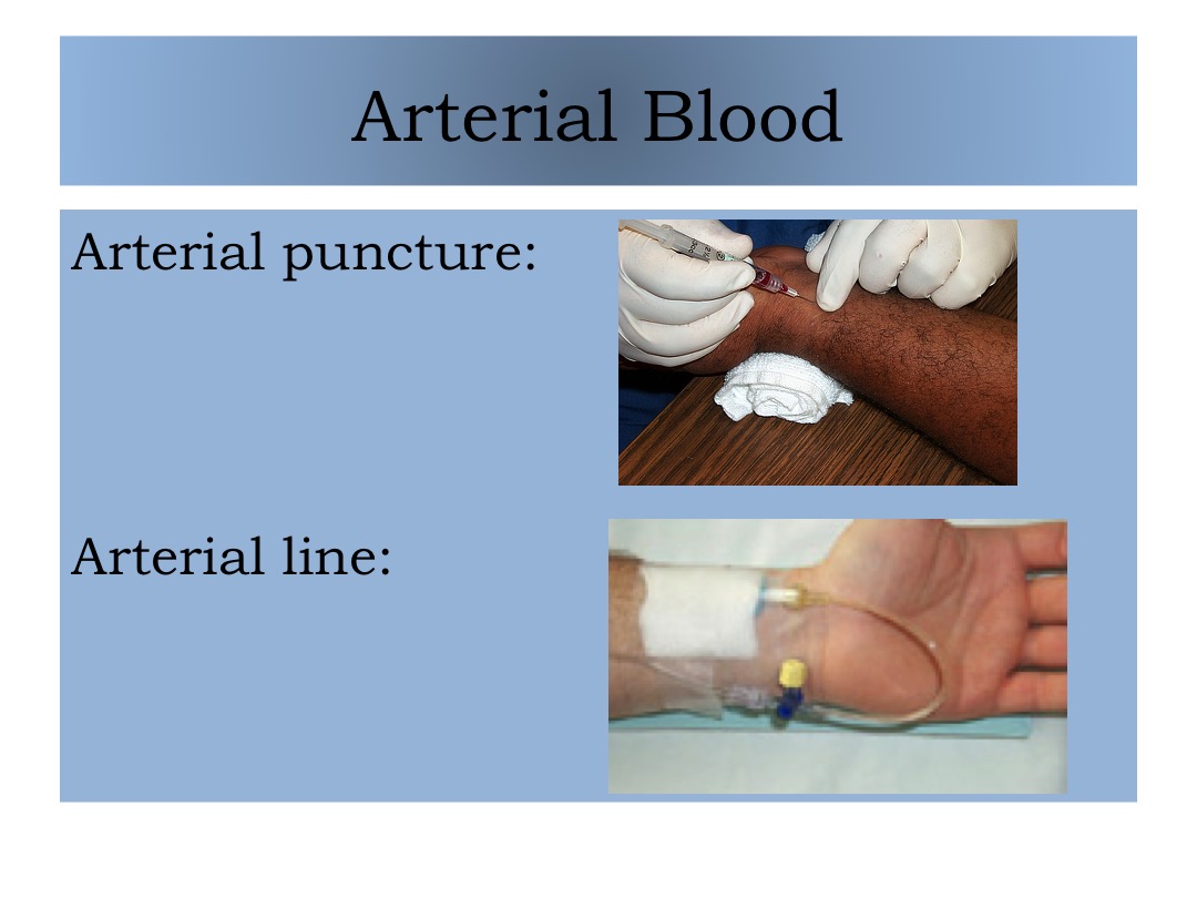 arterial puncture slide image #2