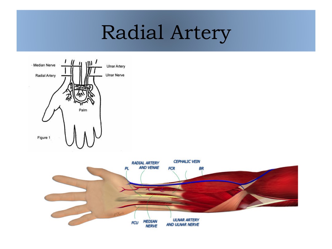 Radial Artery 1 slide image