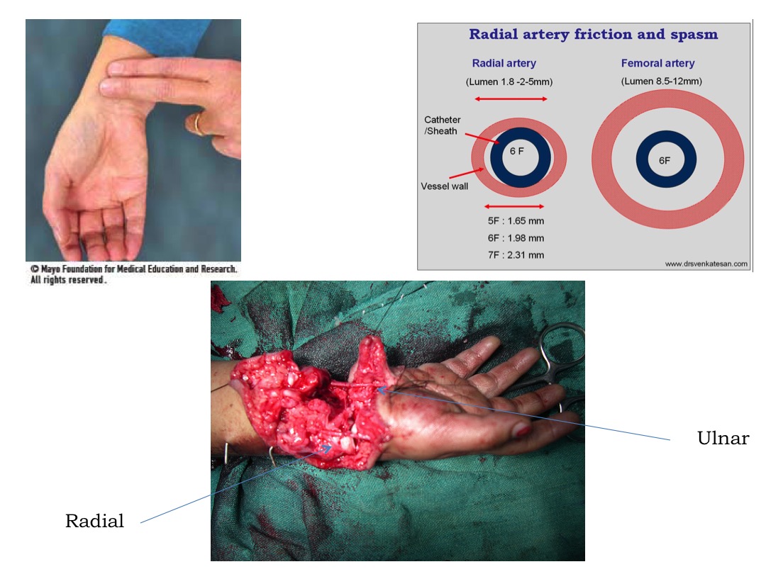 Radial Artery 2 slide image #2