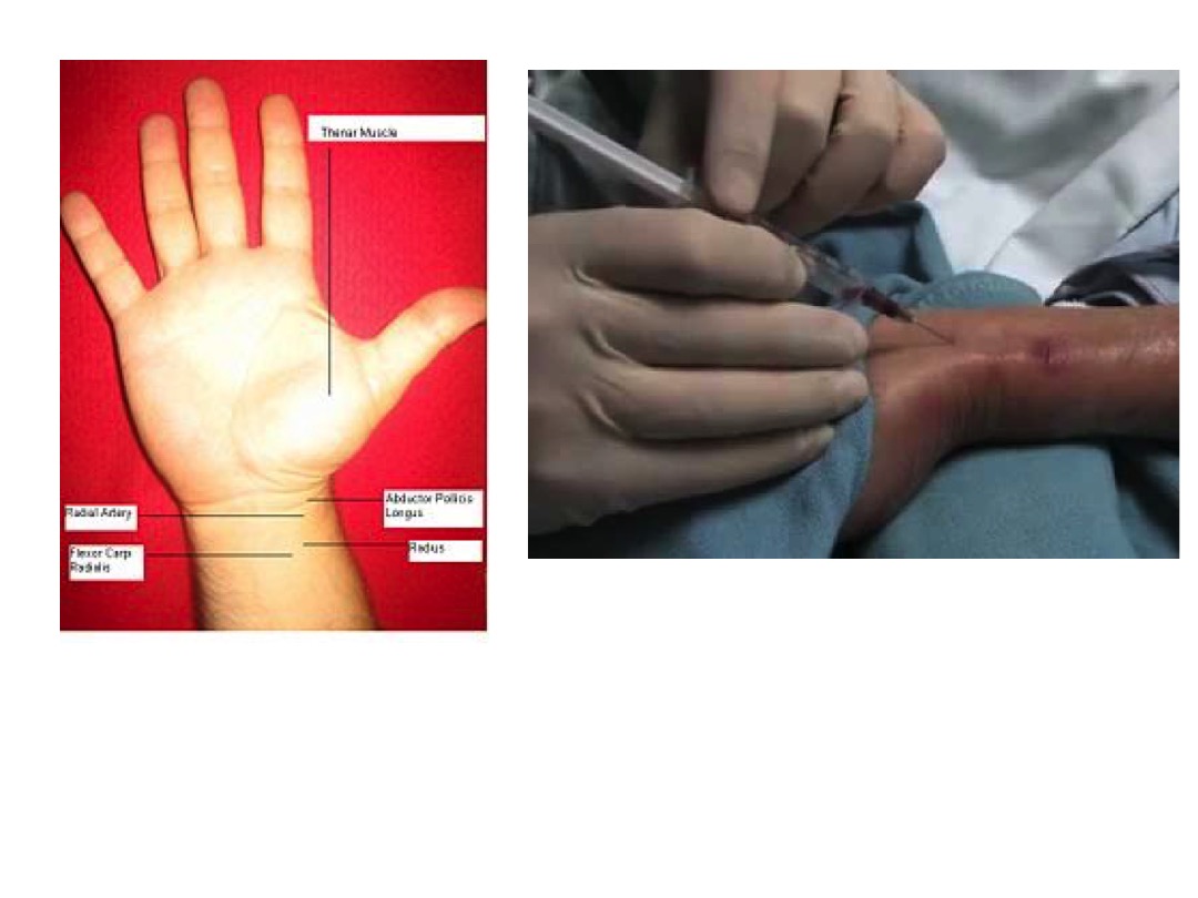 Radial Artery 4 slide image #3