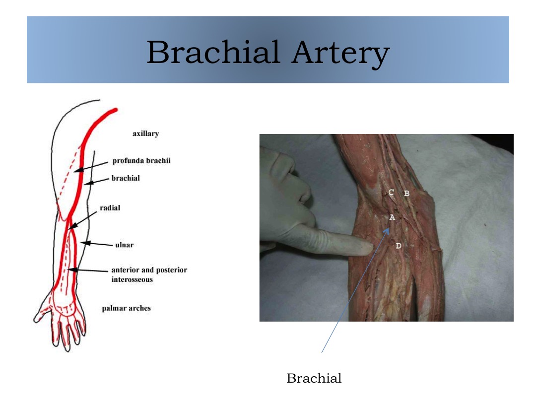 Brachial Artery slide image