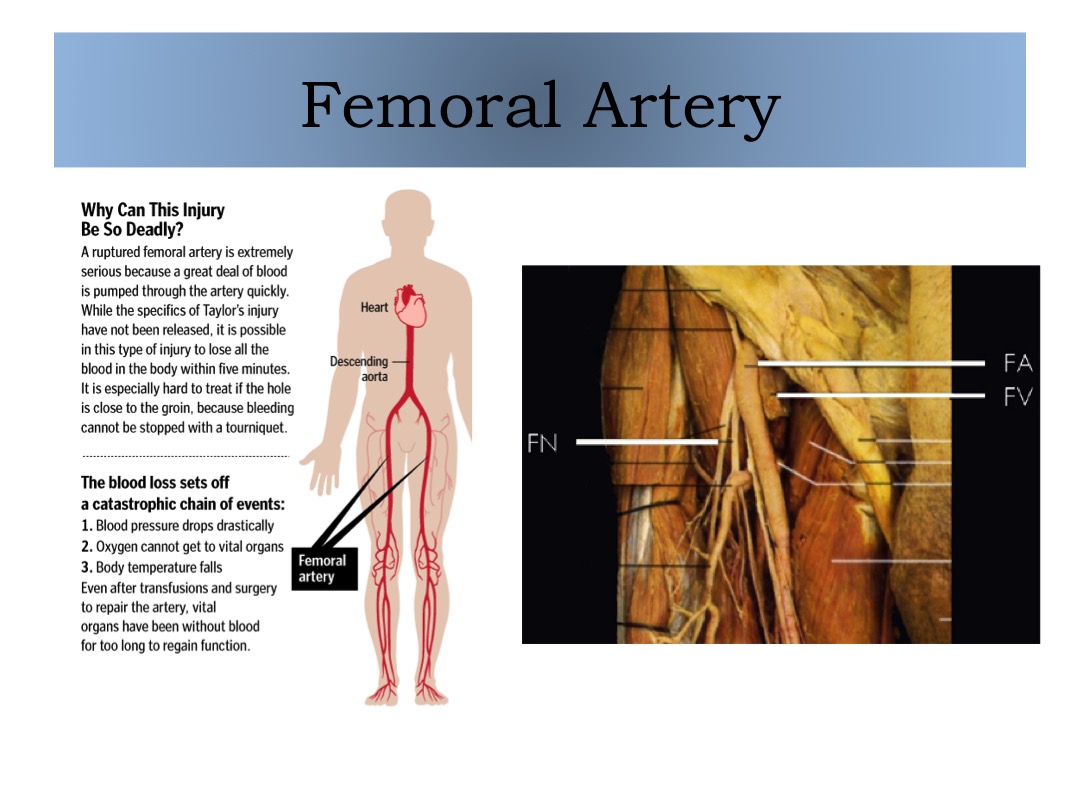 Femoral Artery 1 slide image